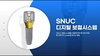 SNUC Prosthetic System SNUC디지털 보철 체결방법