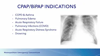 November 23 MEC Minute: CPAP & BiPAP