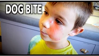 DOG BITE To The FACE! (Hilarious Kid Tells the Story) | Dr. Paul