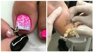 Most Satisfying Pedicure transformation 😱 best nail polish for toes 2020