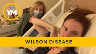 The reality of living with Wilson Disease | Your Morning