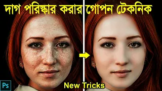 Photo Retouching New Techniques : How to Remove Dark Spots, Blemishes & Acne Scars Use Channel Mask
