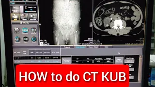 CT scan KUB Protocol.