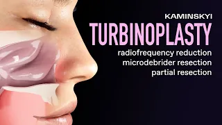 Turbinoplasty: Radiofrequency reduction, Microdebrider resection, Partial resection / KAMINSKYI