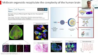 Patient-specific Organoids