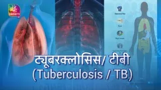 Ayushman Bhava: Tuberculosis | TB | ट्यूबरक्लोसिस | टीबी | तपेदिक | 27 March, 2023