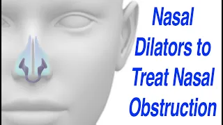 Nasal Dilator to Treat Nasal Obstruction without Meds, Surgery, or Breath Right Strips