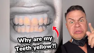 Orthodontist Exposes The REAL Reason Your Teeth Are Yellow *Surprising*
