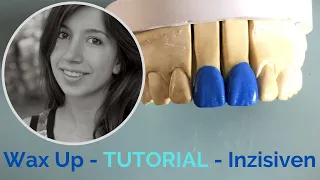 Wax-Up Tutorial: Perfecting Incisors 11 & 21 [Inzisiven with Explanation] for Dental Technicians