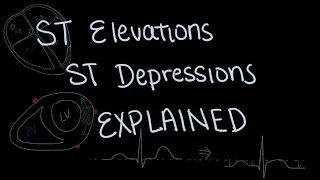 Physiology of ST Segment Elevation and Depression Explained