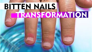 QUICKEST TRANSFORMATION OF BITTEN GEL NAILS BY PROFESSIONAL! STEP BY STEP DETAILED TUTORIAL