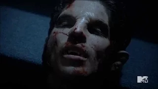 Teen Wolf 5x10 - Scott Turns Back From Dead "Scott Roar"