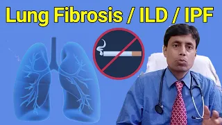 ILD Definition and Types // IPF // Pulmonary Fibrosis // NSIP // Dr Sanjay chest specialist