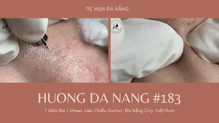 #183 | Huong Da Nang