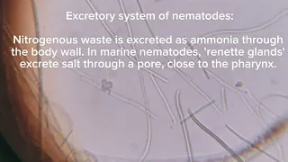 Nematodes #Anatomy #Digestive system #Reproduction #Nervous system #Classification #Excretory system