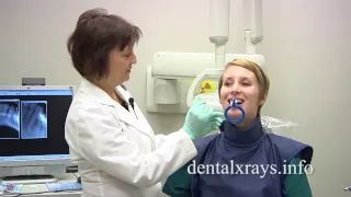 How to take dental x-rays when the patient has a narrow palate