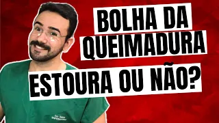 BOLHA DA QUEIMADURA: ESTOURA OU NÃO? APRENDA AGORA