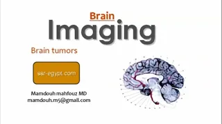 Imaging of supratentorial Brain tumors (DRE) Prof. Mamdouh Mahfouz