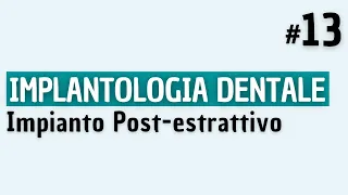 Implantologia Dentale - Impianto Postestrattivo