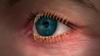 Tyrvaya Dry Eye Disease Treatment at Texas State Optical