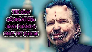 Rolf Buchholz: Meet The Man With A World Record For Most Body Modifications
