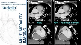 Cardiac CT: Current Technology & Principles (Faisal Nabi, MD, FACC) September 11, 2018