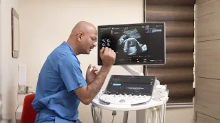 Fetal HS AI guided feature of Voluson Expert 22