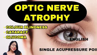Optic Nerve Atrophy single Acupressure point by Purvi Maru in English