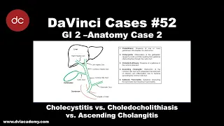 Cholecystitis vs Choledocholithiasis vs Ascending Cholangitis [#DaVinciCases GI 2 - Anatomy Case 2]