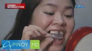 Murang DIY veneers na mabibili online, ligtas nga bang gamitin? | Pinoy MD