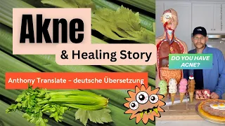 Akne – Die Ursache sind Streptokokken – Anthony William – deutsche Übersetzung