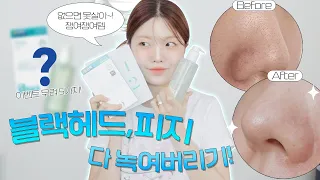 마켓공지🥇파워지성의 피지&블랙헤드 케어템 top2🎖️없으면 불안해.. 한달에 한통씩 싹싹비움