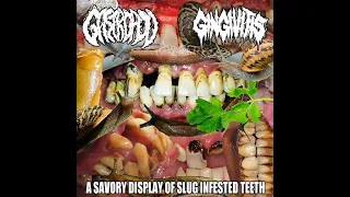 Gastropod - (2022) Split Gingivitis (Gastropod side)