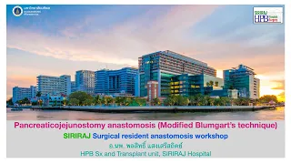 Pancreaticojejunostomy anastomosis (Modified Blumgart’s technique)