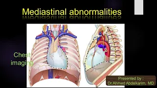 11- Mediastinal abnormalities