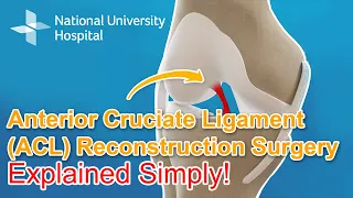 Anterior Cruciate Ligament (ACL) Reconstruction Surgery - Explained