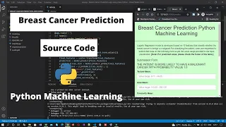 Breast Cancer Prediction Machine Learning Project Source Code