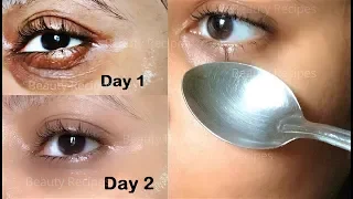 How to Remove Under Eye WRINKLES, Under Eye Bags, Puffy eyes & Dark Circles in 1 Day with ice cubes