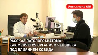 Рассказ патологоанатома: как меняется организм человека под влиянием ковида