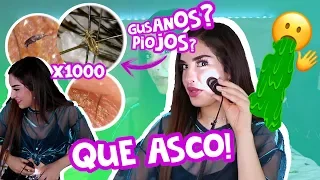 ASÍ SE VE MI CARA Y CUERPO BAJO UN MICROSCOPIO 🔬🤢 Kimberly Loaiza