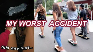 my worst longboarding accident...