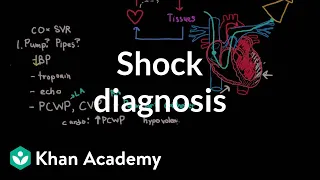 Shock - diagnosis and treatment | Circulatory System and Disease | NCLEX-RN | Khan Academy