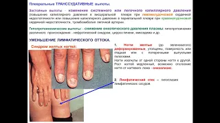 Синдром поражения плевры