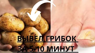 ГрИбОк НоГоТеЙ можно убрать за 5-10 минут обычным.......