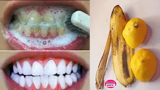 At home teeth whitening diy in 3 minutes / fastest way to whiten teeth at home - lemon banana peels