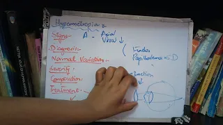 HYPERMETROPIA important topic full explanation part 2