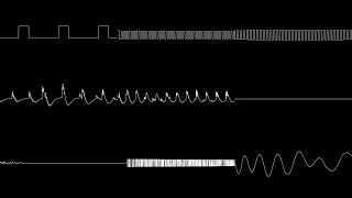 Sonic Advance 2 - True Area 53 (oscilloscope view)