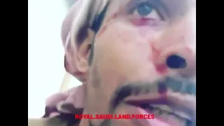 جندي من جنود السعودي يصاب من قناص حوثي