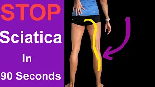 90 Second Sciatic Pain Relief