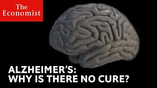 Why is Alzheimer's still a medical mystery?